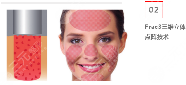 欧洲之星fotona4Dpro价格多少钱一次?科普抗衰紧肤新秀! 欧洲之星fotona4Dpro价格多少钱一次?科普抗衰紧肤新秀!