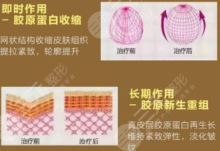 不要盲目的补充胶原蛋白
