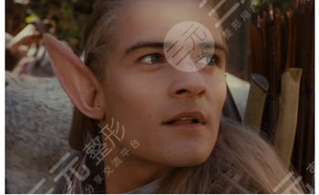 颅耳角在30°-60°之间朵怎么整形？矫正尖耳朵，手术科普来袭！