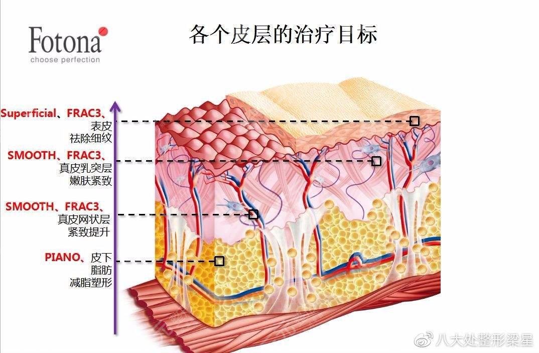欧洲之星做几次有果