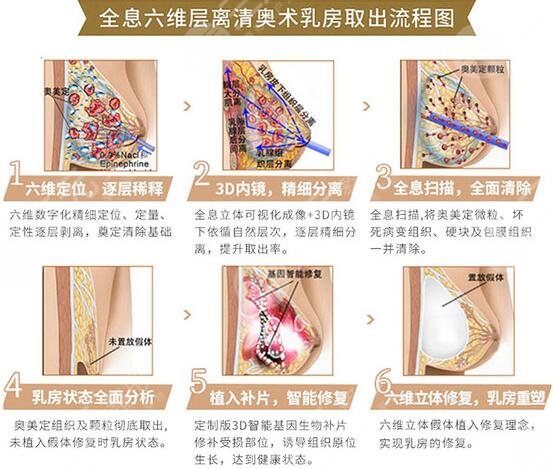 奥美定取出手术怎么做