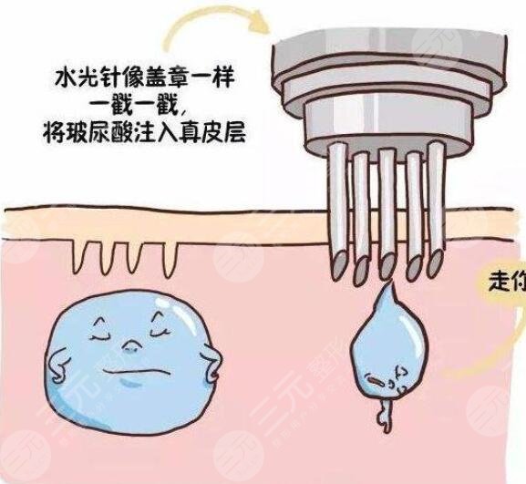 打完水光补水多久可以做欧洲之星