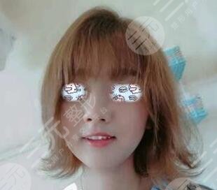 做欧洲之星抗衰后