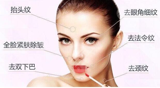 北京五代热玛吉的多少钱