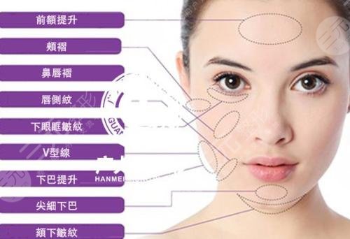 热玛吉的价格多少