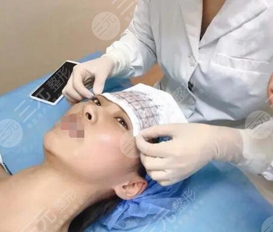 做热玛吉的费用是多少呢
