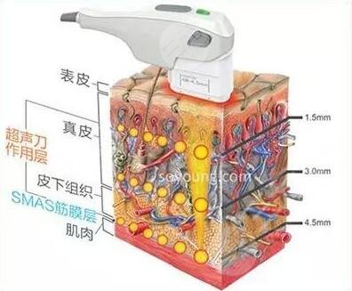 热玛吉原理