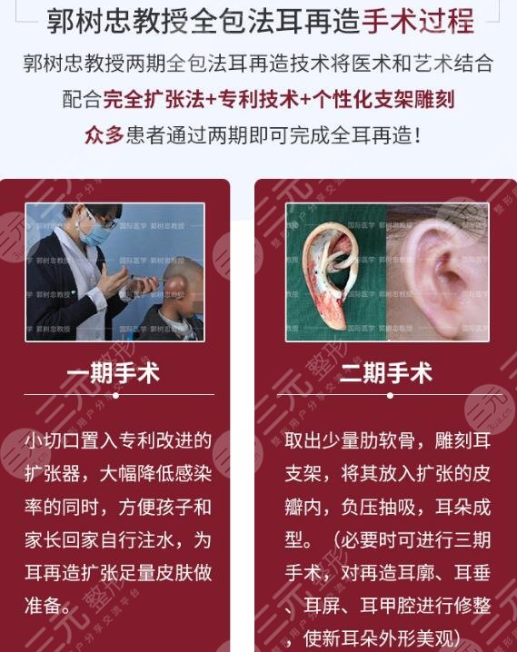 耳再造手术大概多少天