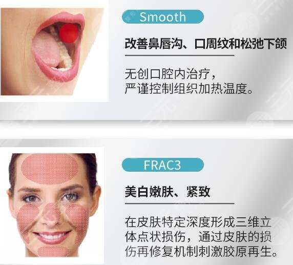 欧洲之星fotona4dpro价格