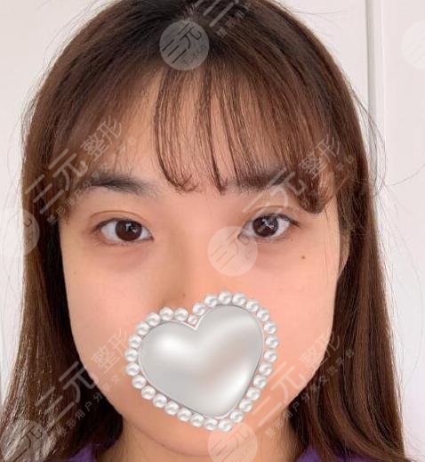 颌面手术整形前