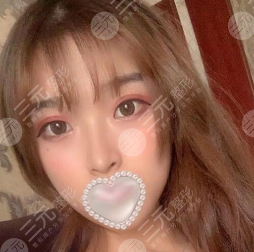 颌面手术整形后12周