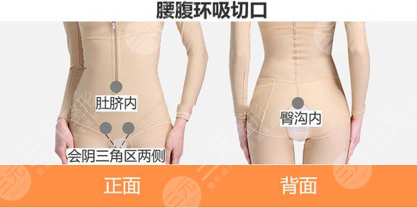 上海腰腹环吸价格
