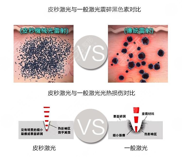 欧洲之星祛斑好还是蜂巢激光pm去斑好