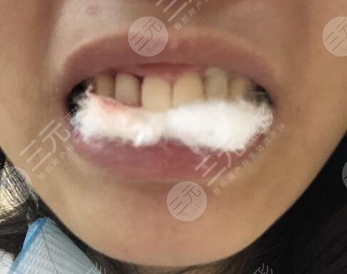 六安高峰口腔价格表