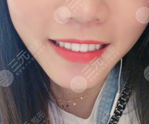 六安高峰口腔价格表