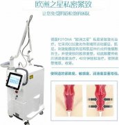 fotona欧洲之星缩阴成好吗？维持多久？科普女性私密好帮手！