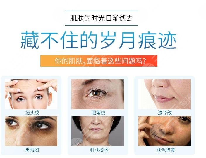 做热玛吉怎么做可以延**果维持时间