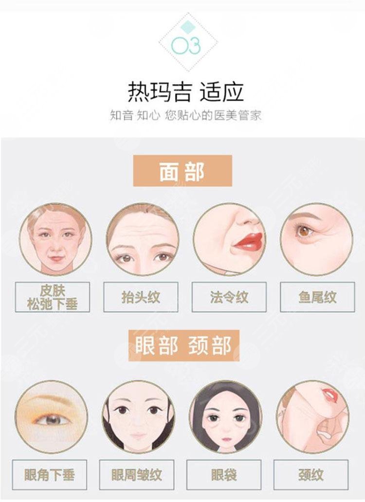 热玛注射瘦脸宜人群
