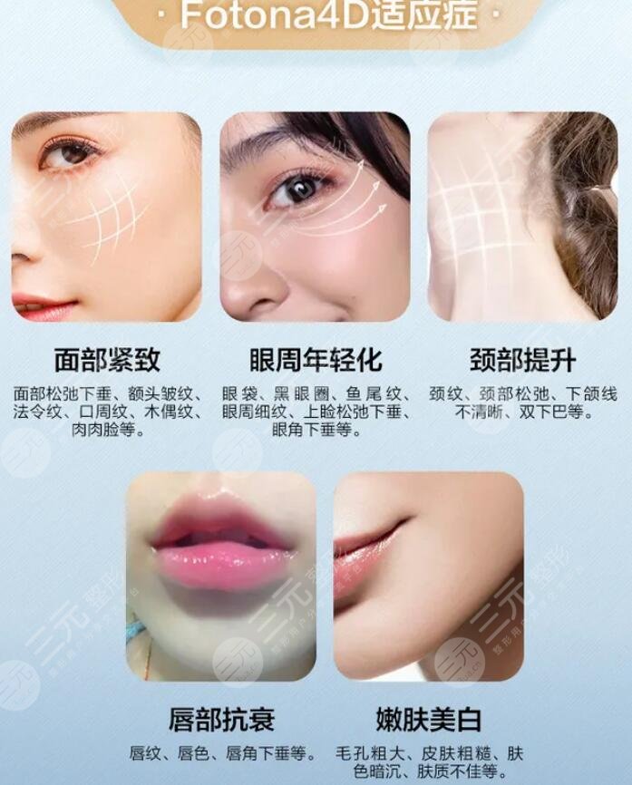 欧洲之星的果