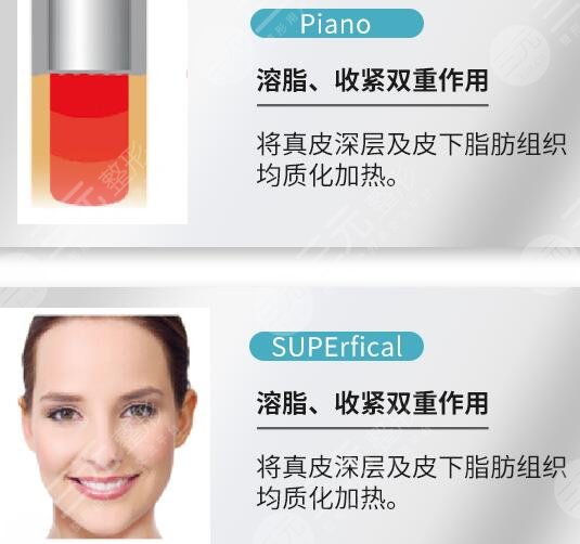 欧洲之星优点