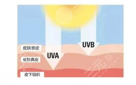 热玛吉是什么