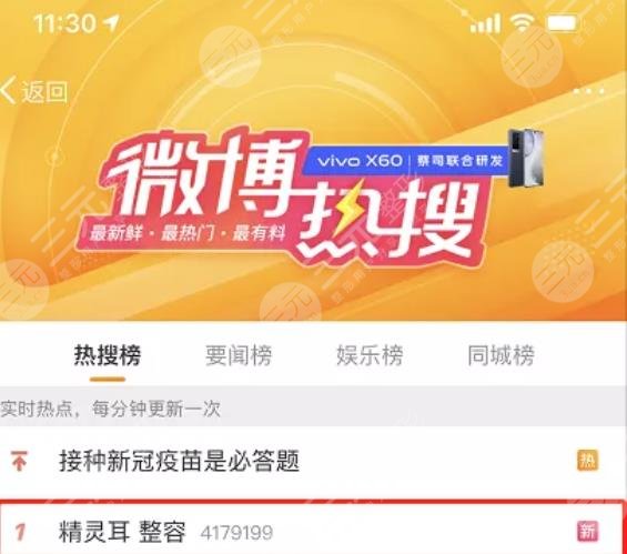 颅耳角在30°-60°之间朵怎么整形