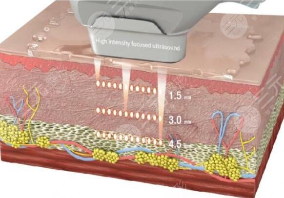 光电提拉作用的原理