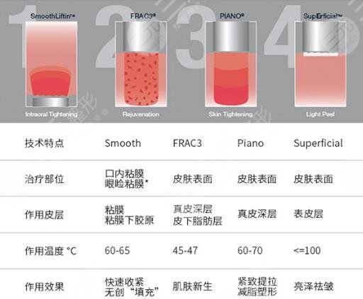 蜂巢激光pm和欧洲之星果对比