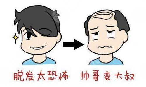 术前必看|5000个毛囊植发的价格是多少？4个价格影响因素！