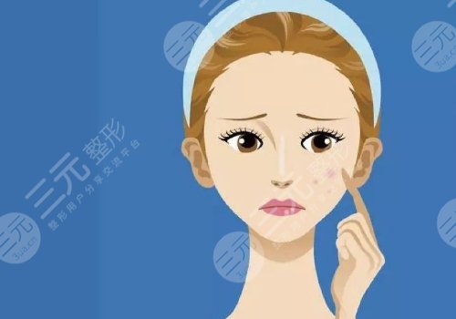 光子嫩肤的价格一般是多少？科普价格&注意事项，果图分享！