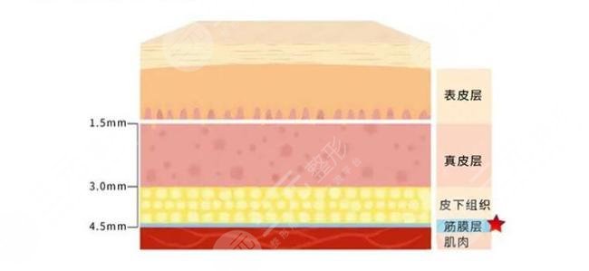 7d聚拉提和热玛吉的区别