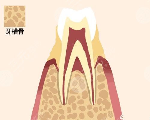 牙齿松动是什么原因?