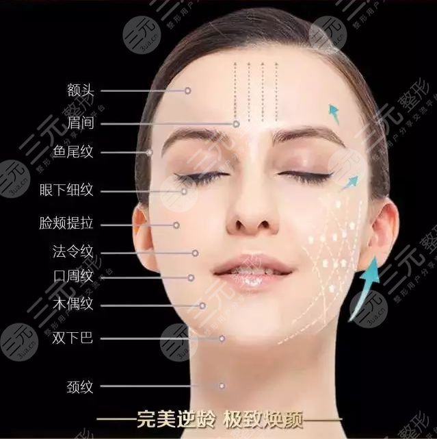 7d聚拉提做脸大概多少钱