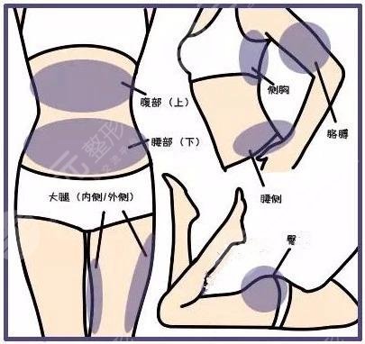 冷冻溶脂减肥靠谱吗