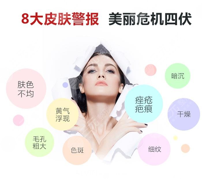 光子嫩肤的优势