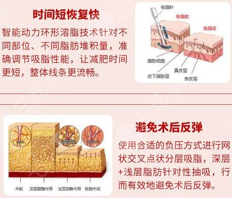 射频射腿的优势