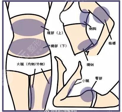 射频瘦腿的手术注意事项