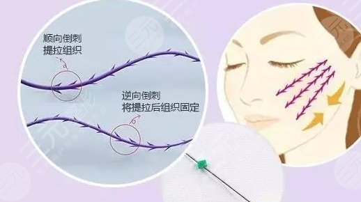 提升抗皱是什么?