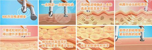 做热玛吉