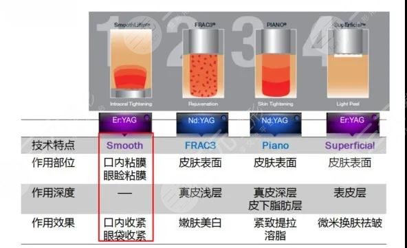 热玛吉和欧洲之星有哪些缺点