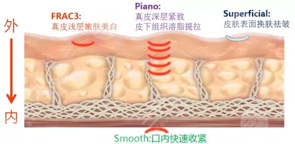 欧洲之星的原理