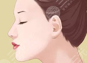 改良肤质