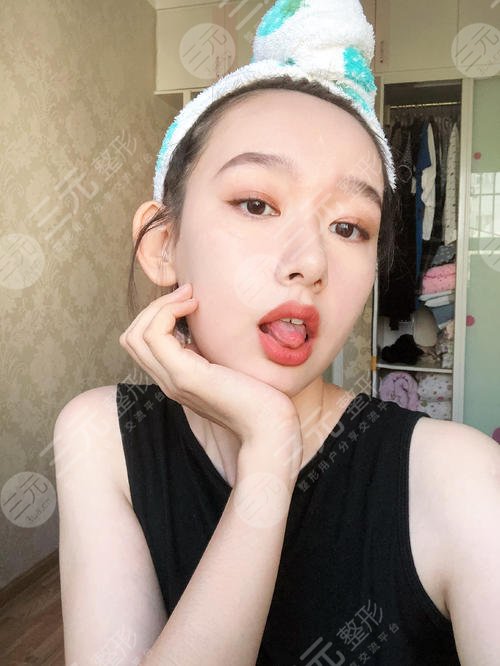 热玛吉全脸多少钱|真实案例