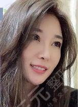 热玛吉全脸多少钱|真实案例