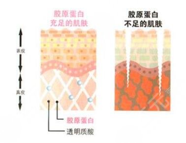 盲目的补充胶原蛋白