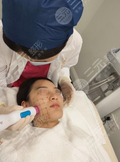 做热玛吉需要多长时间做完