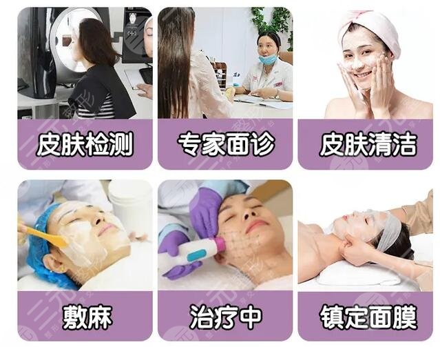 做热玛吉流程