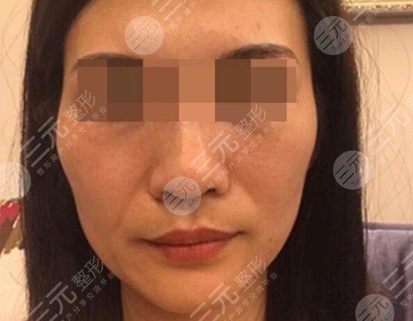 面部肌肤