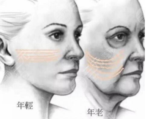 做热玛吉