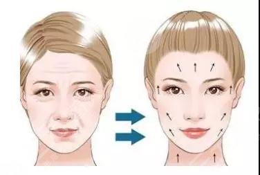 热玛吉的功作用及副作用